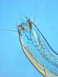 The mouth region of the marine enoplid nematode Epacanthion sp.