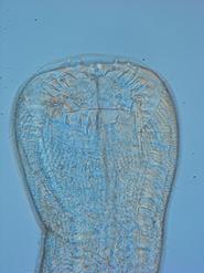 The mouth region of a new species of nematode from Capron Shoals, FL. Many sharp, inward-facing teeth can be seen. These are likely used to scrape algae from sediment particles in feeding.